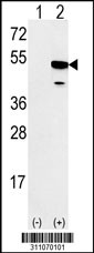 Western blot analysis of his-tag VIL1 (arrow) using his tag antibody. 293 cell lysates (2 ug/lane) either nontransfected (Lane 1) or transiently transfected with the VIL1 gene