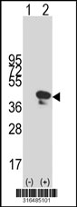 Western blot analysis of his-tag VSX2 (arrow) using his tag antibody. 293T cell lysates (2 ug/lane) either nontransfected (Lane 1) or transiently transfected with the VSX2 gene‘