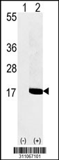 Western blot analysis of his-tag SNRPD1 (arrow) using his tag antibody. 293 cell lysates (2 ug/lane) either nontransfected (Lane 1) or transiently transfected with the SNRPD1 gene