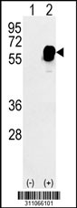 Western blot analysis of his-tag SMAD4 (arrow) using his tag antibody. 293 cell lysates (2 ug/lane) either nontransfected (Lane 1) or transiently transfected with the SMAD4 gene