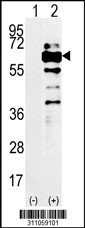 Western blot analysis of his-tag NOC4L (arrow) using his tag antibody. 293 cell lysates (2 ug/lane) either nontransfected (Lane 1) or transiently transfected with the NOC4L gene