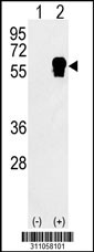 Western blot analysis of his-tag NARS (arrow) using his tag antibody. 293 cell lysates (2 ug/lane) either nontransfected (Lane 1) or transiently transfected with the NARS gene