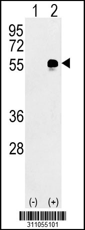 Western blot analysis of his-tag KPNA3 (arrow) using his tag antibody. 293 cell lysates (2 ug/lane) either nontransfected (Lane 1) or transiently transfected with the KPNA3 gene
