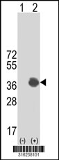 Western blot analysis of his-tag CSGALNACT1 (arrow) using his tag antibody. 293T cell lysates (2 ug/lane) either nontransfected (Lane 1) or transiently transfected with the CSGALNACT1 gene‘