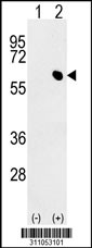 Western blot analysis of his-tag IRF4 (arrow) using his tag antibody. 293 cell lysates (2 ug/lane) either nontransfected (Lane 1) or transiently transfected with the IRF4 gene