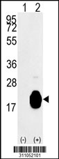 Western blot analysis of his-tag IFITM3 (arrow) using his tag antibody. 293 cell lysates (2 ug/lane) either nontransfected (Lane 1) or transiently transfected with the IFITM3 gene