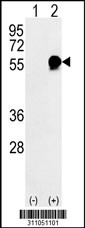 Western blot analysis of his-tag HSPD1 (arrow) using his tag antibody. 293 cell lysates (2 ug/lane) either nontransfected (Lane 1) or transiently transfected with the HSPD1 gene
