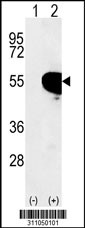 Western blot analysis of his-tag HNRNPF (arrow) using his tag antibody. 293 cell lysates (2 ug/lane) either nontransfected (Lane 1) or transiently transfected with the HNRNPF gene