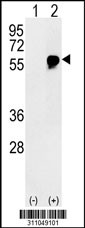 Western blot analysis of his-tag HACL1 (arrow) using his tag antibody. 293 cell lysates (2 ug/lane) either nontransfected (Lane 1) or transiently transfected with the HACL1 gene