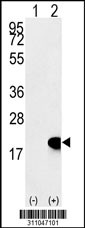 Western blot analysis of his-tag GLRX2 (arrow) using his tag antibody. 293 cell lysates (2 ug/lane) either nontransfected (Lane 1) or transiently transfected with the GLRX2 gene