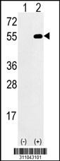 Western blot analysis of his-tag DARS (arrow) using his tag antibody. 293 cell lysates (2 ug/lane) either nontransfected (Lane 1) or transiently transfected with the DARS gene