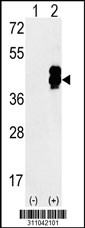 Western blot analysis of his-tag CLCN2 (arrow) using his tag antibody. 293 cell lysates (2 ug/lane) either nontransfected (Lane 1) or transiently transfected with the CLCN2 gene