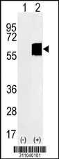 Western blot analysis of his-tag ACVR1B (arrow) using his tag antibody. 293 cell lysates (2 ug/lane) either nontransfected (Lane 1) or transiently transfected with the ACVR1B gene