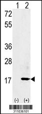 Western blot analysis of his-tag TSPAN31 (arrow) using his tag antibody. 293 cell lysates (2 ug/lane) either nontransfected (Lane 1) or transiently transfected with the TSPAN31 gene