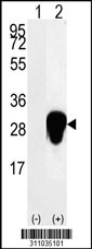Western blot analysis of his-tag TPI1 (arrow) using his tag antibody. 293 cell lysates (2 ug/lane) either nontransfected (Lane 1) or transiently transfected with the TPI1 gene