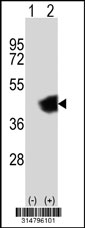 Western blot analysis of his-tag DHRS7B (arrow) using his tag antibody. 293T cell lysates (2 ug/lane) either nontransfected (Lane 1) or transiently transfected with the DHRS7B gene‘