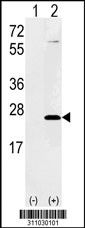 Western blot analysis of his-tag PXMP4 (arrow) using his tag antibody. 293 cell lysates (2 ug/lane) either nontransfected (Lane 1) or transiently transfected with the PXMP4 gene
