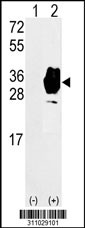 Western blot analysis of his-tag PROCR (arrow) using his tag antibody. 293 cell lysates (2 ug/lane) either nontransfected (Lane 1) or transiently transfected with the PROCR gene