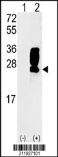 Western blot analysis of his-tag ORM2 (arrow) using his tag antibody. 293 cell lysates (2 ug/lane) either nontransfected (Lane 1) or transiently transfected with the ORM2 gene