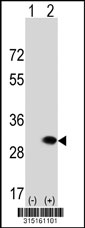 Western blot analysis of his-tag NUPL2 (arrow) using his tag antibody. 293T cell lysates (2 ug/lane) either nontransfected (Lane 1) or transiently transfected with the NUPL2 gene‘