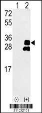 Western blot analysis of his-tag HPX (arrow) using his tag antibody. 293 cell lysates (2 ug/lane) either nontransfected (Lane 1) or transiently transfected with the HPX gene