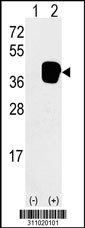 Western blot analysis of his-tag HOMER3 (arrow) using his tag antibody. 293 cell lysates (2 ug/lane) either nontransfected (Lane 1) or transiently transfected with the HOMER3 gene