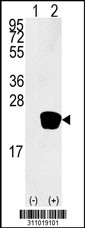 Western blot analysis of his-tag GSTP1 (arrow) using his tag antibody. 293 cell lysates (2 ug/lane) either nontransfected (Lane 1) or transiently transfected with the GSTP1 gene