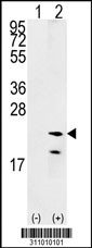 Western blot analysis of his-tag BAX (arrow) using his tag antibody. 293 cell lysates (2 ug/lane) either nontransfected (Lane 1) or transiently transfected with the BAX gene