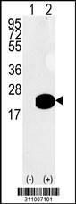 Western blot analysis of his-tag HMGA1 (arrow) using his tag antibody. 293 cell lysates (2 ug/lane) either nontransfected (Lane 1) or transiently transfected with the HMGA1 gene
