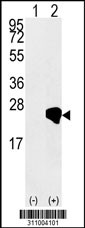 Western blot analysis of his-tag SKP1 (arrow) using his tag antibody. 293 cell lysates (2 ug/lane) either nontransfected (Lane 1) or transiently transfected with the SKP1 gene