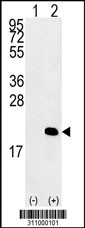 Western blot analysis of his-tag RNF5 (arrow) using his tag antibody. 293 cell lysates (2 ug/lane) either nontransfected (Lane 1) or transiently transfected with the RNF5 gene