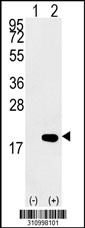Western blot analysis of his-tag PEA15 (arrow) using his tag antibody. 293 cell lysates (2 ug/lane) either nontransfected (Lane 1) or transiently transfected with the PEA15 gene