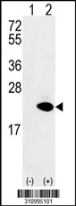 Western blot analysis of his-tag EIF4EBP1 (arrow) using his tag antibody. 293 cell lysates (2 ug/lane) either nontransfected (Lane 1) or transiently transfected with the EIF4EBP1 gene