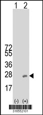 Western blot analysis of his-tag DAND5 (arrow) using his tag antibody. 293T cell lysates (2 ug/lane) either nontransfected (Lane 1) or transiently transfected with the DAND5 gene‘
