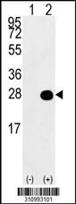 Western blot analysis of his-tag MED28 (arrow) using his tag antibody. 293 cell lysates (2 ug/lane) either nontransfected (Lane 1) or transiently transfected with the MED28 gene