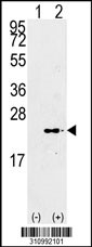 Western blot analysis of his-tag MB (arrow) using his tag antibody. 293 cell lysates (2 ug/lane) either nontransfected (Lane 1) or transiently transfected with the MB gene