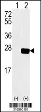 Western blot analysis of his-tag LSM1 (arrow) using his tag antibody. 293 cell lysates (2 ug/lane) either nontransfected (Lane 1) or transiently transfected with the LSM1 gene