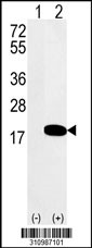 Western blot analysis of his-tag LSM3 (arrow) using his tag antibody. 293 cell lysates (2 ug/lane) either nontransfected (Lane 1) or transiently transfected with the LSM3 gene