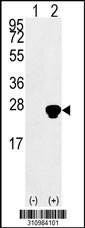Western blot analysis of his-tag GADD45A (arrow) using his tag antibody. 293 cell lysates (2 ug/lane) either nontransfected (Lane 1) or transiently transfected with the GADD45A gene