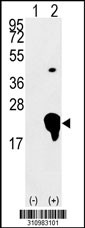 Western blot analysis of his-tag FHL3 (arrow) using his tag antibody. 293 cell lysates (2 ug/lane) either nontransfected (Lane 1) or transiently transfected with the FHL3 gene