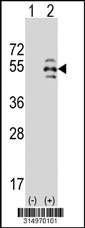 Western blot analysis of his-tag KIAA1712 (arrow) using his tag antibody. 293T cell lysates (2 ug/lane) either nontransfected (Lane 1) or transiently transfected with the KIAA1712 gene‘
