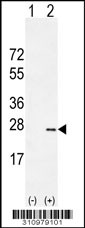 Western blot analysis of his-tag BIK (arrow) using his tag antibody. 293 cell lysates (2 ug/lane) either nontransfected (Lane 1) or transiently transfected with the BIK gene