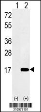 Western blot analysis of his-tag PSENEN (arrow) using his tag antibody. 293 cell lysates (2 ug/lane) either nontransfected (Lane 1) or transiently transfected with the PSENEN gene