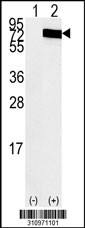 Western blot analysis of his-tag XRCC6 (arrow) using his tag antibody. 293 cell lysates (2 ug/lane) either nontransfected (Lane 1) or transiently transfected with the XRCC6 gene
