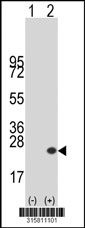 Western blot analysis of his-tag APITD1 (arrow) using his tag antibody. 293T cell lysates (2 ug/lane) either nontransfected (Lane 1) or transiently transfected with the APITD1 gene‘