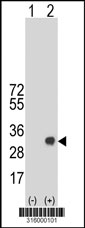 Western blot analysis of his-tag MED20 (arrow) using his tag antibody. 293T cell lysates (2 ug/lane) either nontransfected (Lane 1) or transiently transfected with the MED20 gene‘