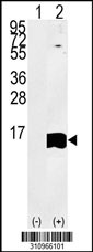 Western blot analysis of his-tag LSM5 (arrow) using his tag antibody. 293 cell lysates (2 ug/lane) either nontransfected (Lane 1) or transiently transfected with the LSM5 gene