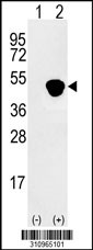 Western blot analysis of his-tag TALDO1 (arrow) using his tag antibody. 293 cell lysates (2 ug/lane) either nontransfected (Lane 1) or transiently transfected with the TALDO1 gene