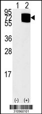 Western blot analysis of his-tag PRC1 (arrow) using his tag antibody. 293 cell lysates (2 ug/lane) either nontransfected (Lane 1) or transiently transfected with the PRC1 gene