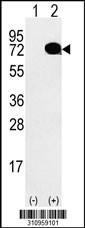 Western blot analysis of his-tag PPIL2 (arrow) using his tag antibody. 293 cell lysates (2 ug/lane) either nontransfected (Lane 1) or transiently transfected with the PPIL2 gene